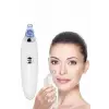 4 Başlıklı Pilli Vakumlu Siyah Nokta Temizleyici Akne Ve Sivilce Önleyici