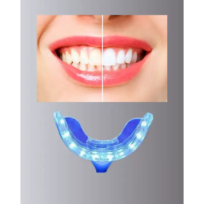 LED Işıklı Profesyonel Diş Beyazlatma Seti