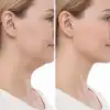 Lenfatik Drenaj Masaj Fırçası