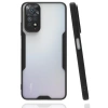 Xiaomi Redmi Note 11 Kılıf Platin Silikon - Siyah