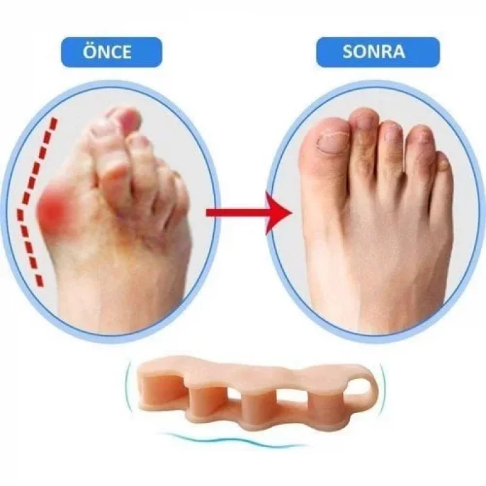 Ayak 5 Parmak Ayıran Geçmeli Silikon Bunyon