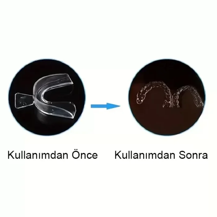 Diş Gıcırdatma Diş Sıkma Çene Sıkma Önleyici Silikon Gece Plağı