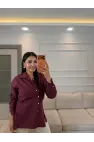Massimo Model Poplin Gömlek