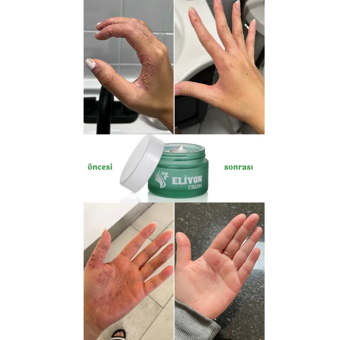 Elivon Akıllı Krem 50 ml