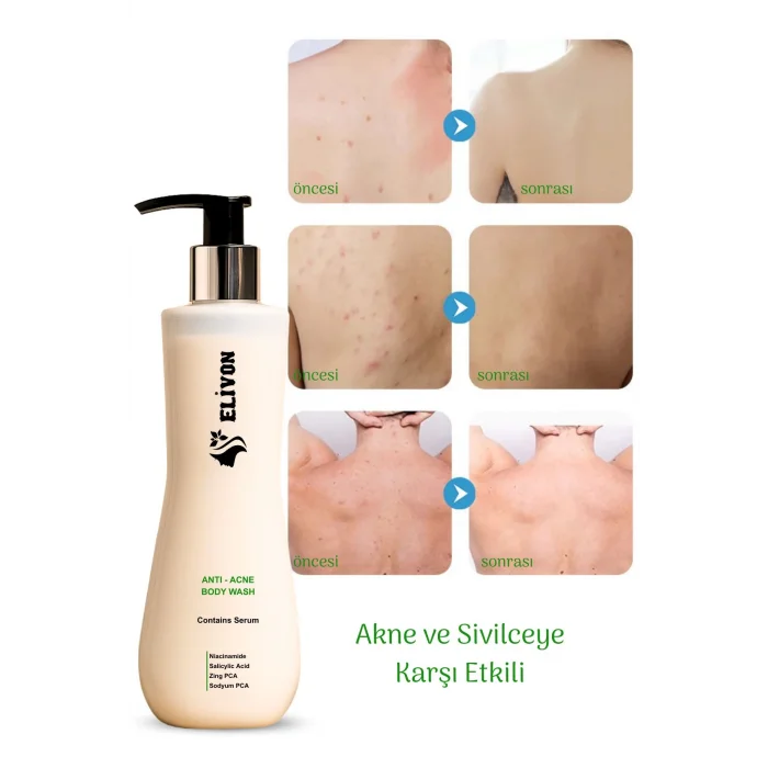 Elivon Anti Acne Body Wash