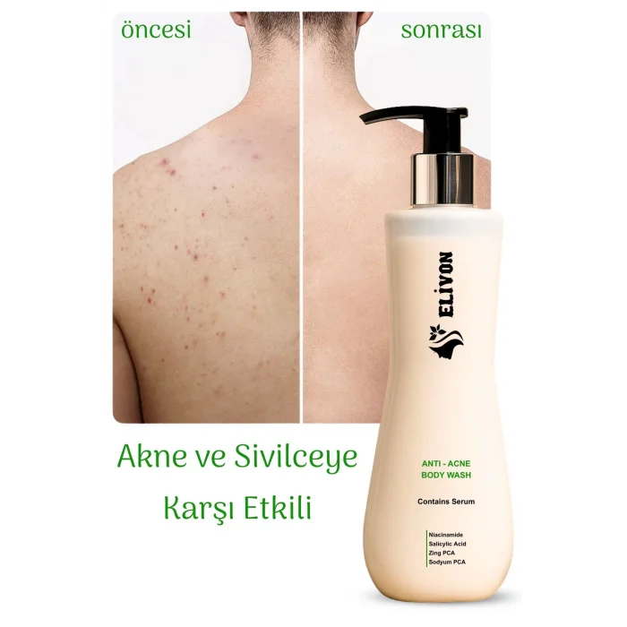 Elivon Anti Acne Body Wash
