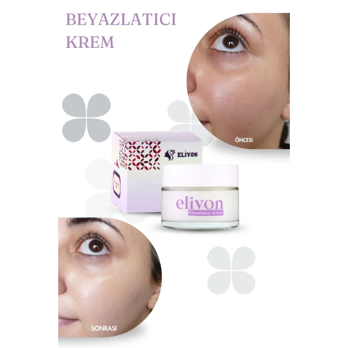 Elivon Beyazlatıcı Krem 40 ml