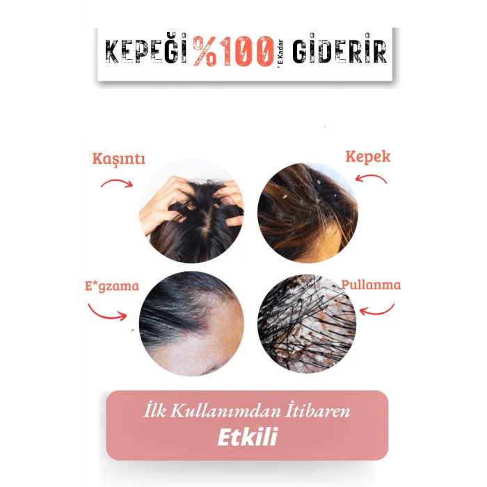 Elivon Kepek Karşıtı Şampuan 200 ML