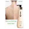 Elivon Anti Acne Body Wash