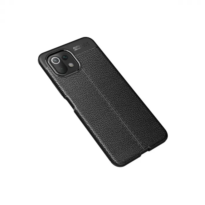 Xiaomi Mi 11 Lite Kılıf Auto Focus Kapak - Siyah