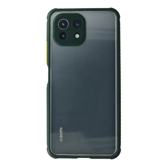 Xiaomi Mi 11 Lite Kılıf Miami Şeffaf Silikon - Koyu Yeşil
