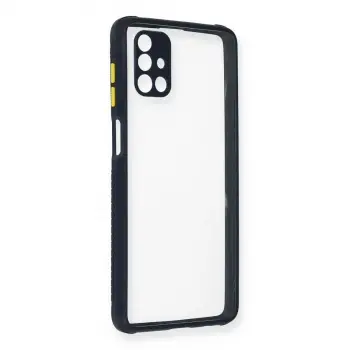 Samsung Galaxy M51 Kılıf Miami Şeffaf Silikon - Lacivert