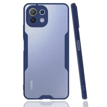 Xiaomi Mi 11 Lite Kılıf Platin Silikon - Lacivert
