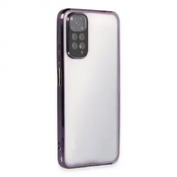 Xiaomi Redmi Note 11 Kılıf Razer Lensli Silikon - Mor