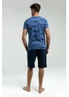 Erkek Mavi Bermuda Takım