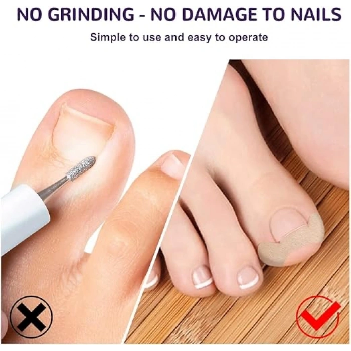 MDB Ayak Tırnağı Düzeltme Bandı 50 Adet