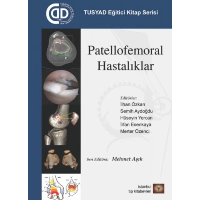 TUSYAD Eğitici Kitap Serisi - Patellofemoral Hastalıklar