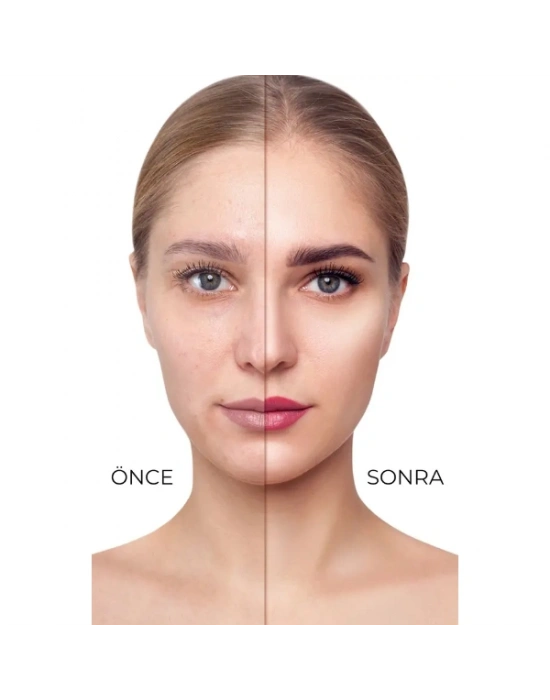 3lü Mat Bitişli Likit Fondöten Seti