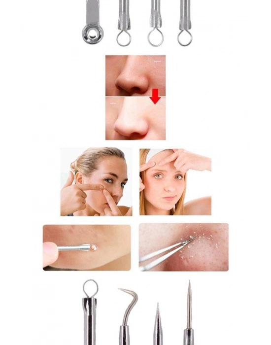 4 Lü Kutulu Paslanmaz Komedon Akne - Siyah Nokta Temizleyici Set