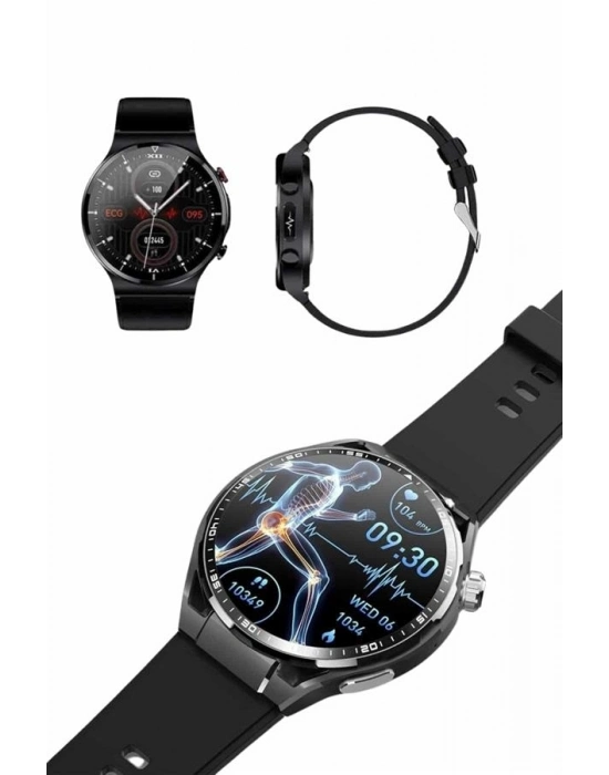 ® Amoled Ekran Akıllı Saat Üç Kordonlu İOS Android Uyumlu