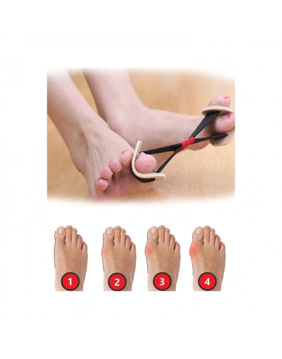 Ayak Baş Parmak Kemik Düzeltici Egzersiz Lastiği