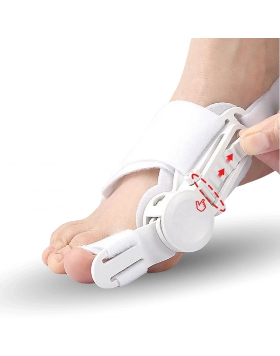 ®  Ayarlanabilir Ayak Baş Parmak Kemik Düzeltici – Halluks Valgus (Bunyon) Aparatı, Gece Gündüz Kullanıma Uygun Ayak Düzeltme Ateli