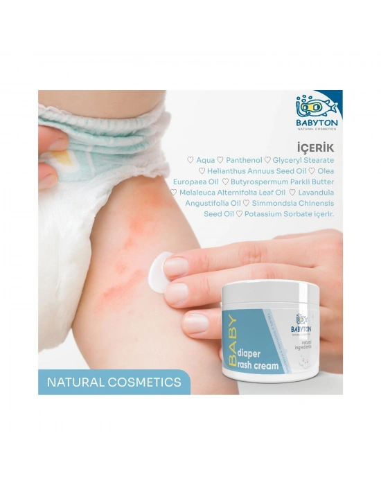 Babyton Diaper Rash Cream 50ml