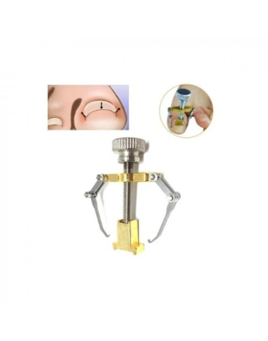 Batık Tırnak Çıkartıcı Aparat