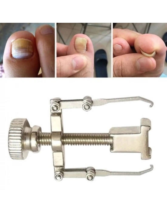 Batık Tırnak Düzeltme Aleti