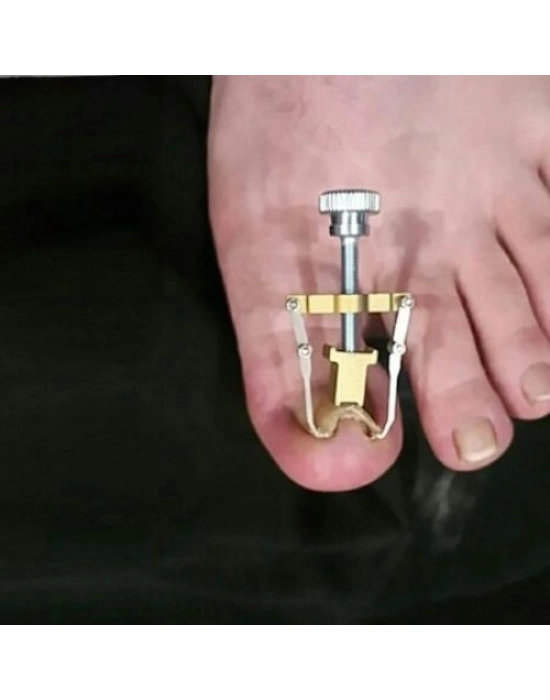 Batık Tırnak Düzeltme Aleti