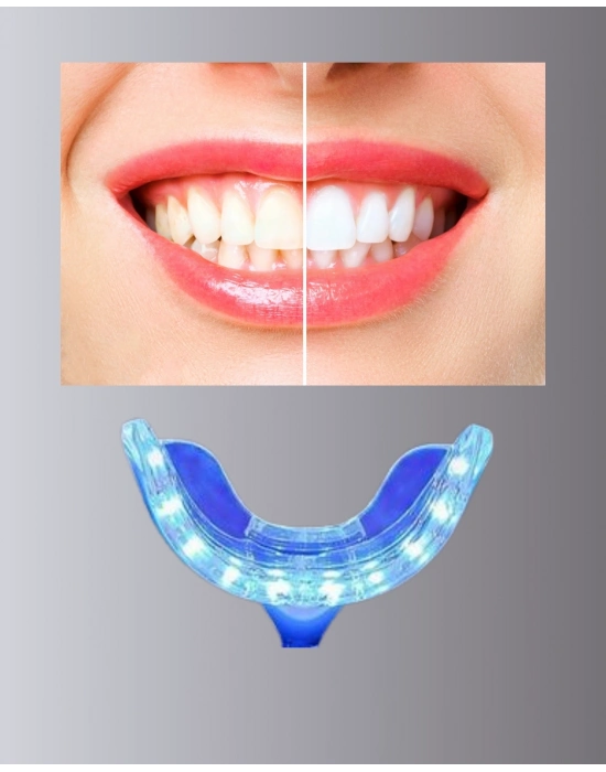 ® 20 Dakikada Hızlı Etkili Diş Beyazlatıcı Cihaz