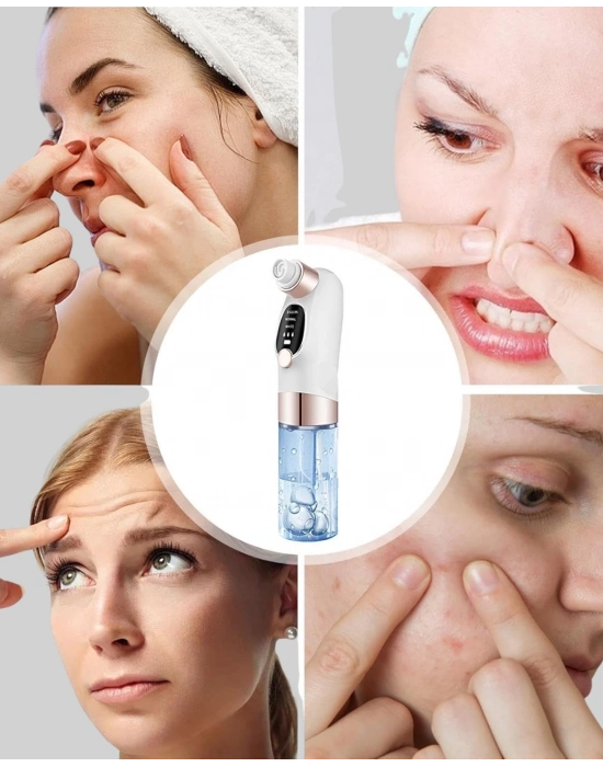 ® Ayarlanabilir Emiş Gücü ile Profesyonel Siyah Nokta Temizleyici