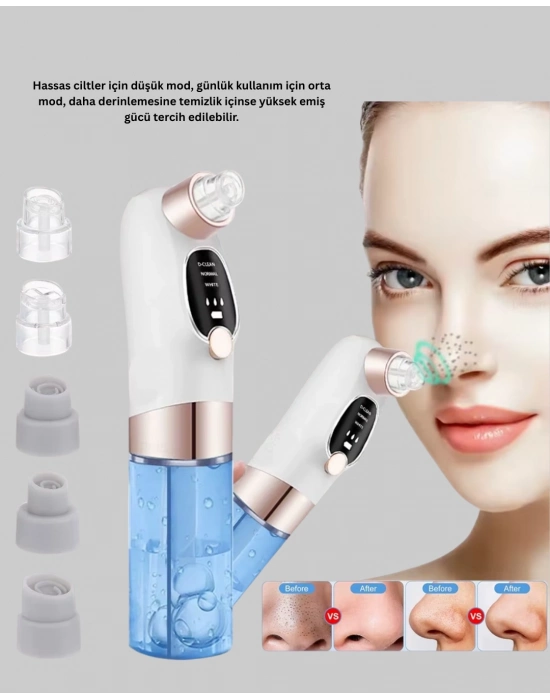 ® Ayarlanabilir Güç Seviyeli Vakumlu Siyah Nokta Temizleme Cihazı – Derin Gözenek Temizliği