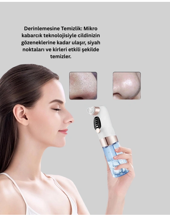 ® Çok Fonksiyonlu Cilt Bakım Cihazı – Siyah Nokta, Gözenek ve Akne Temizleyici