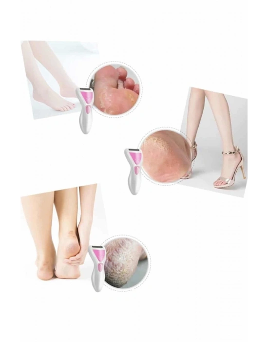 ® Epilatör Cihazı Epilasyon Aleti Çoklu Başlık Seçeneği Ayak Törpüsü