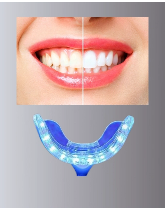 ® LED Işıklı Profesyonel Diş Beyazlatma Seti