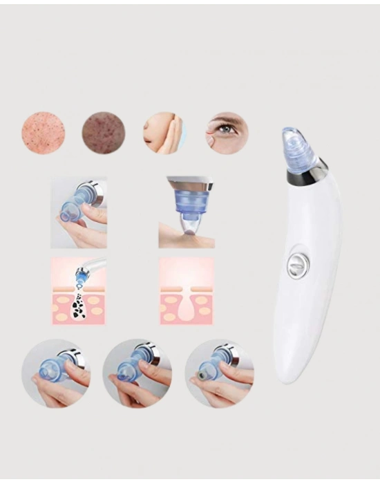 ® Mikro Kristal Başlıklı Siyah Nokta Temizleme Cihazı – Vakum Gücüyle Gözenek Sıkılaştırıcı