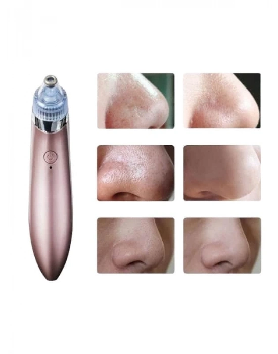 ® SİYAH NOKTA CİHAZI