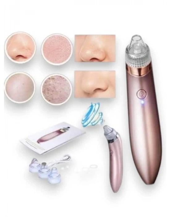 ® SİYAH NOKTA CİHAZI