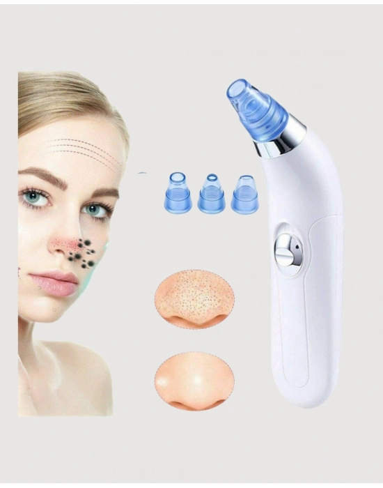 ® USB Destekli 4 Başlıklı Siyah Nokta Vakum Cihazı – Gözenek Temizleyici ve Cilt Yenileyici Bakım Aleti