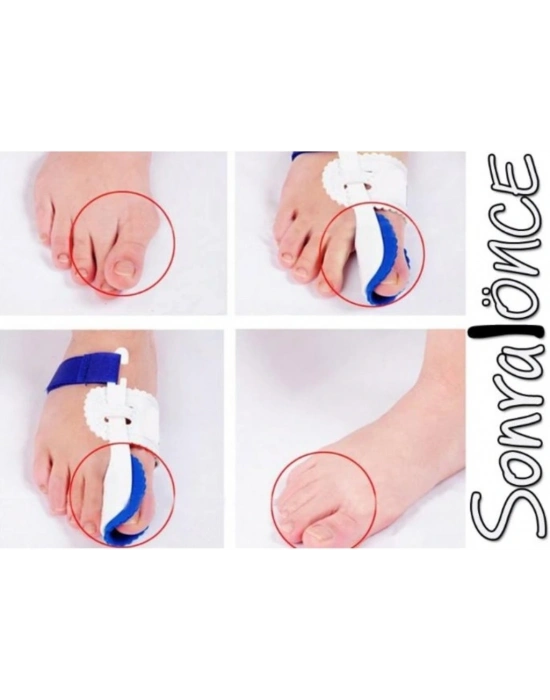 Gece Uyku Parmak Koruyucu