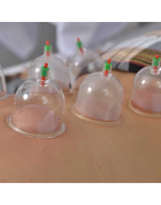 Hacamat Kupa Seti 6 Adet