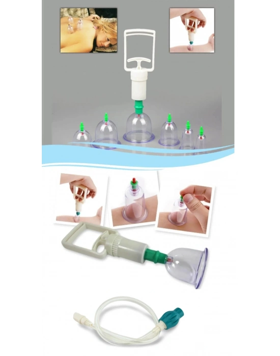 Hacamat Seti Hortumlu - Vakumlu Hortumlu Kupa Çekme Seti (model 2)