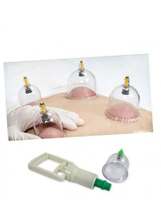 Hacamat Seti Hortumlu - Vakumlu Hortumlu Kupa Çekme Seti (model 2)