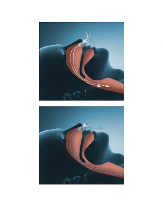 Horlama Önleyici Rahat Uyku Aparatı