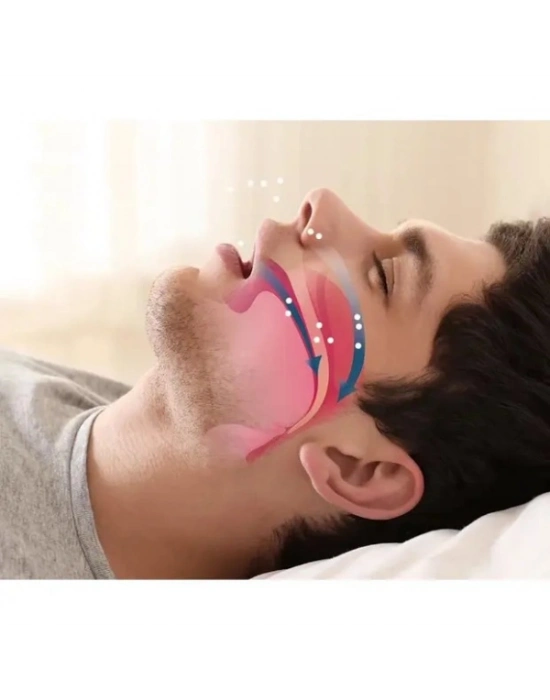 Horlama Önleyici Rahat Uyku Aparatı