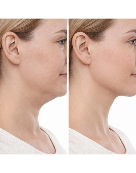 Lenfatik Drenaj Masaj Fırçası