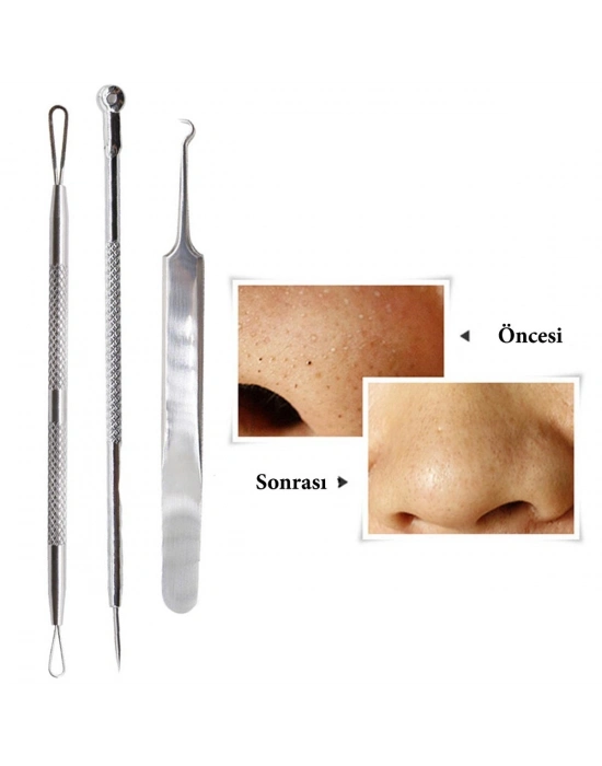 Paslanmaz Çelik Siyah Nokta Sivilce ve Akne Temizleyici Set 3lü Kit