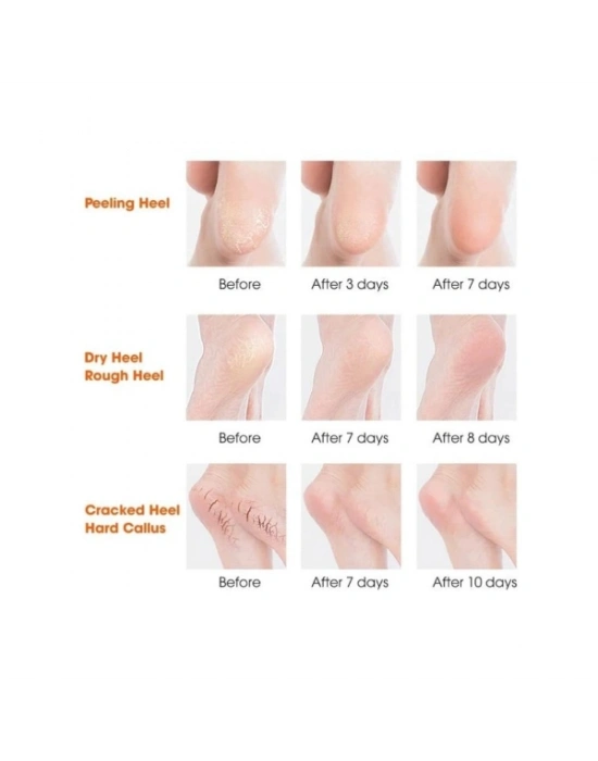 Silikon Topuk Nemlendirici Çorap