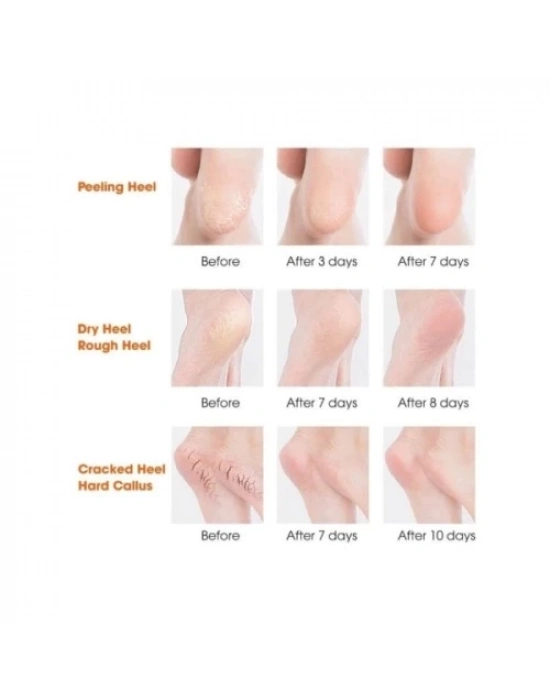 Silikon Topuk Nemlendirici Çorap